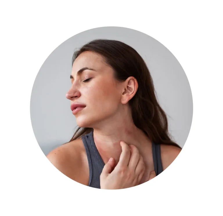 ALERGIA DE LA PIEL-05